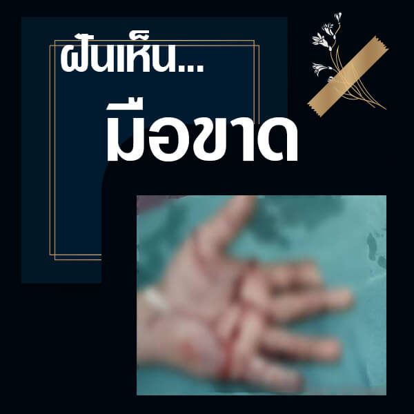 ทำนายฝันมือขาด
