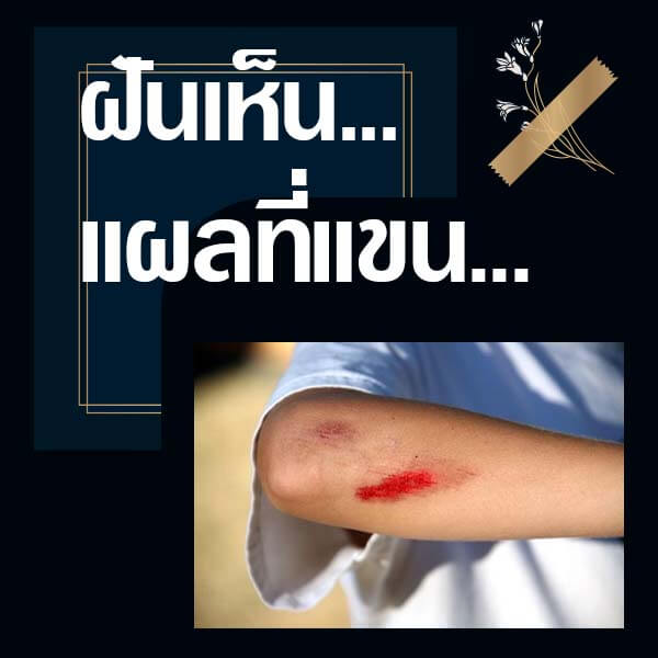 ทำนายฝันเห็นแผลที่แขน